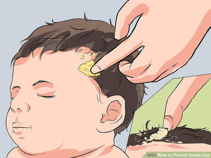 Step 5