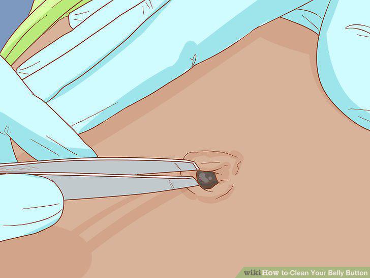 Step 10