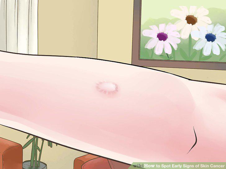 Step 11