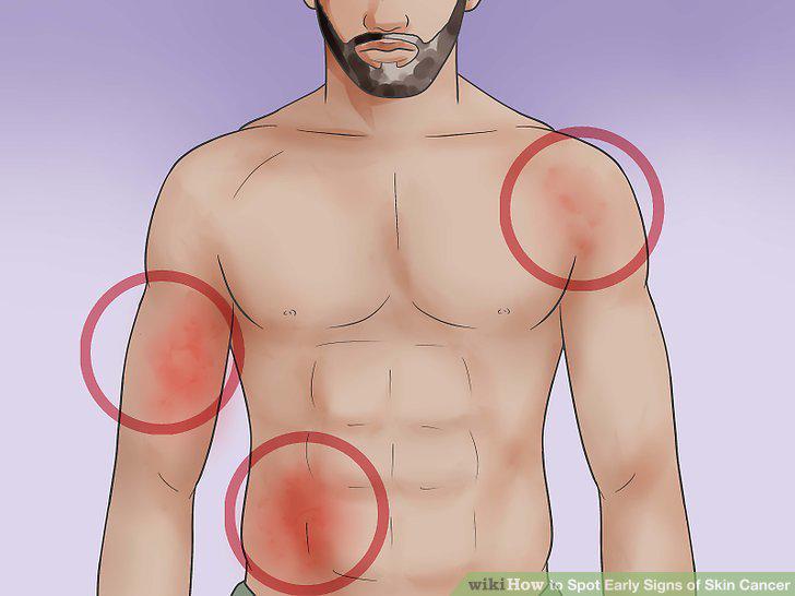 Step 10