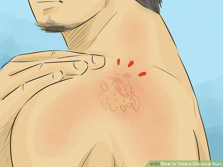 Step 11
