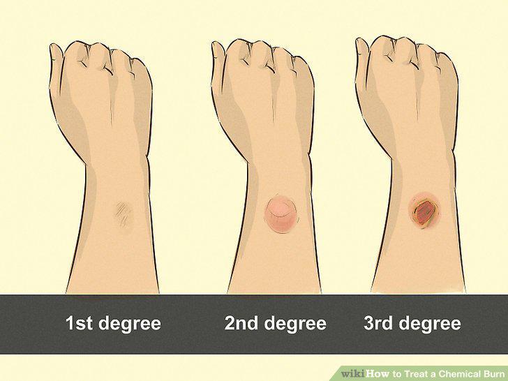 Step 12