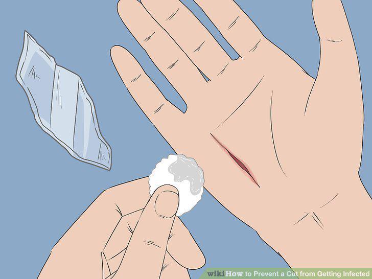 Step 11
