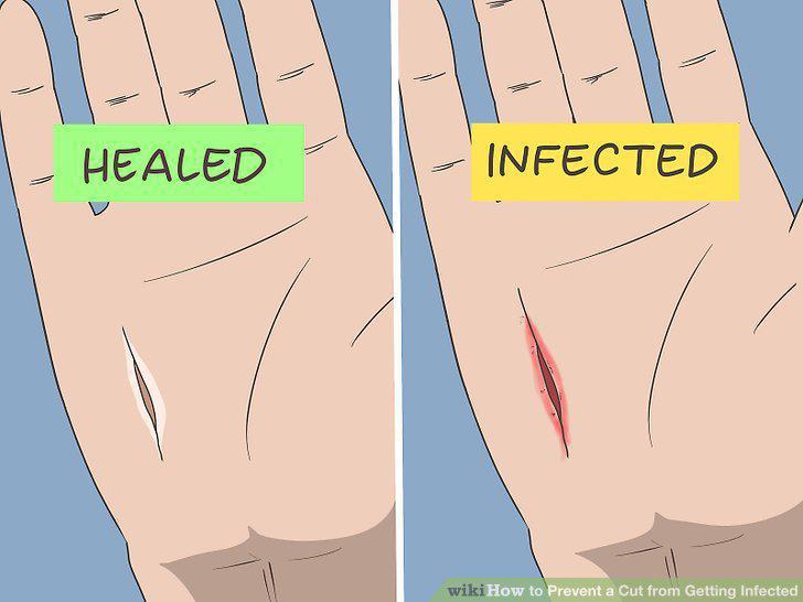 Step 12