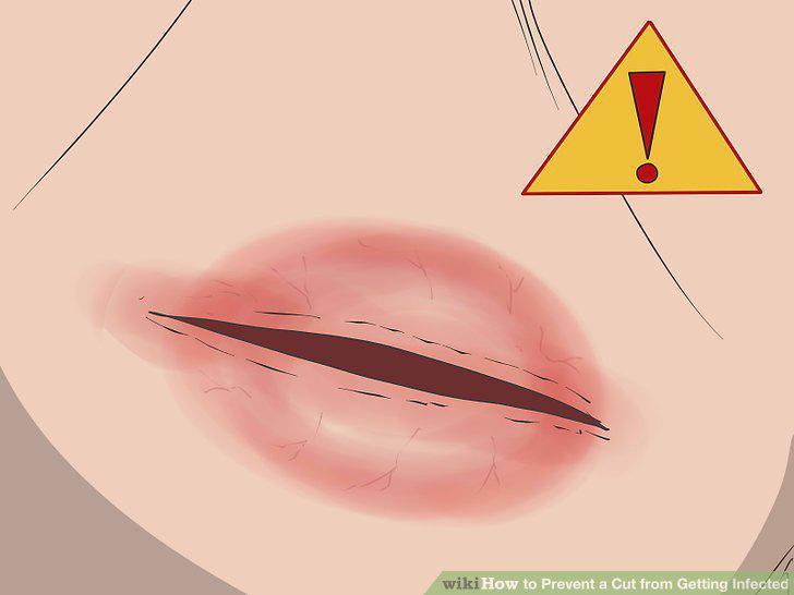 Step 14