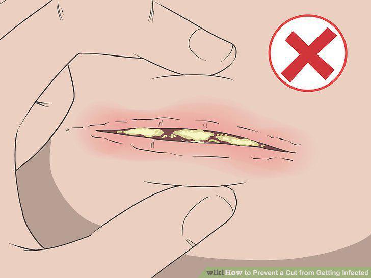 Step 16