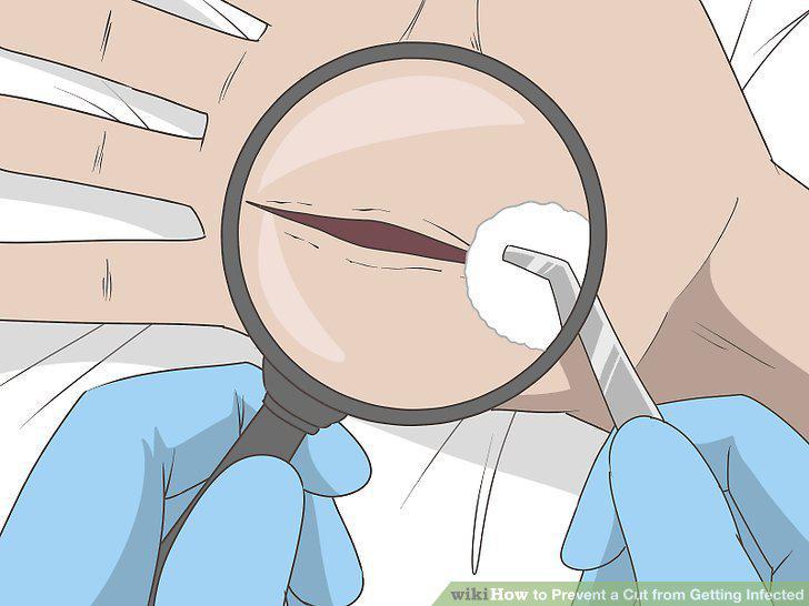 Step 17