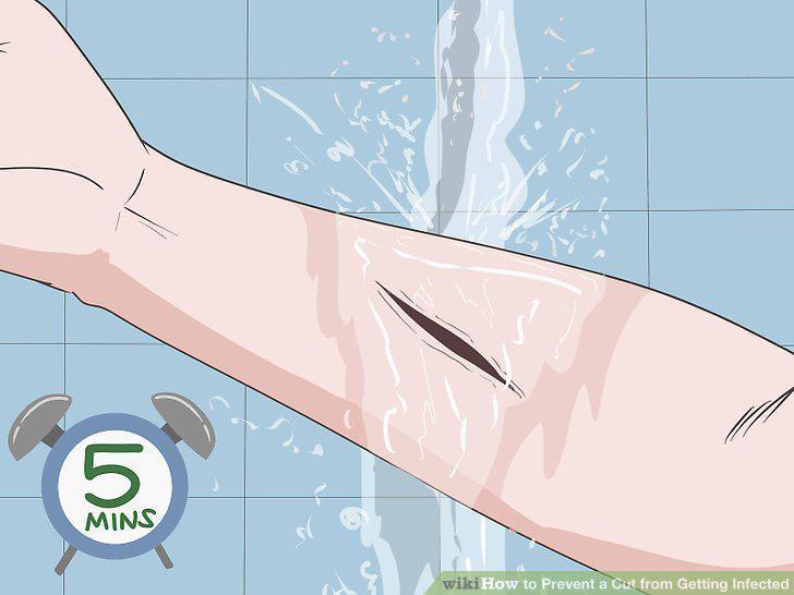 Step 3
