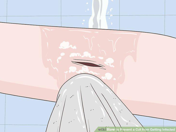 Step 5
