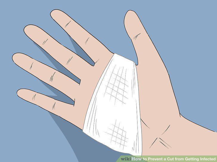 Step 8