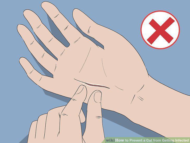 Step 10
