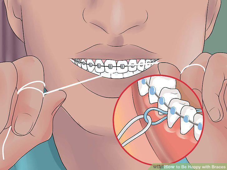 Step 11