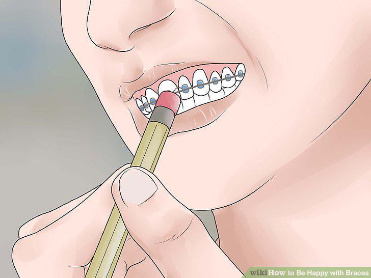 Step 12