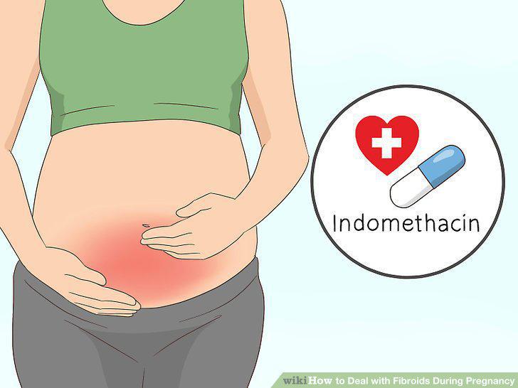 Step 2