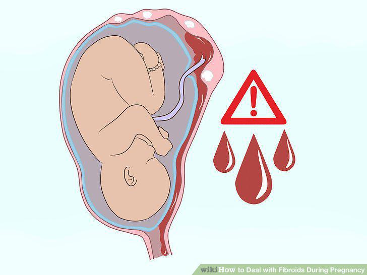 Step 9
