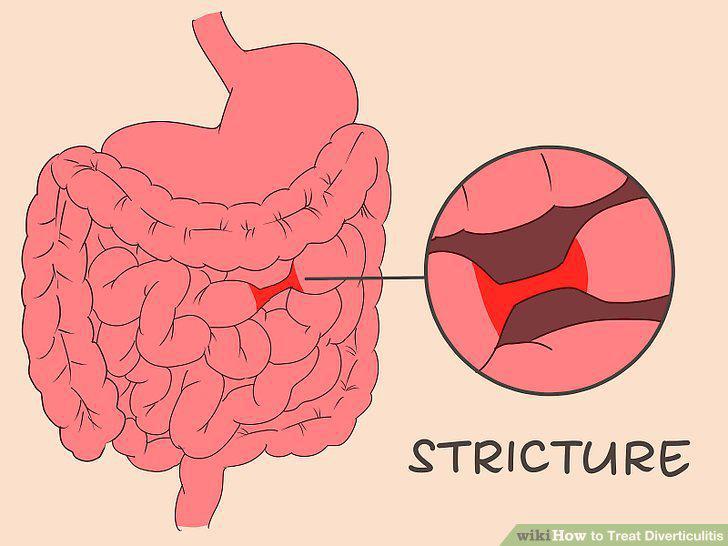 Step 12