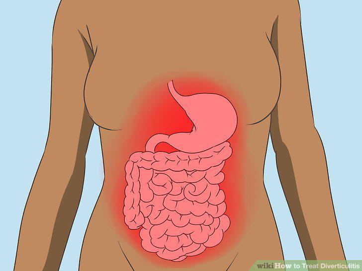 Step 10