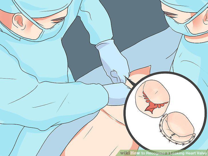 Step 10