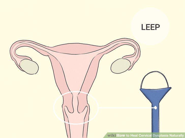 Step 9