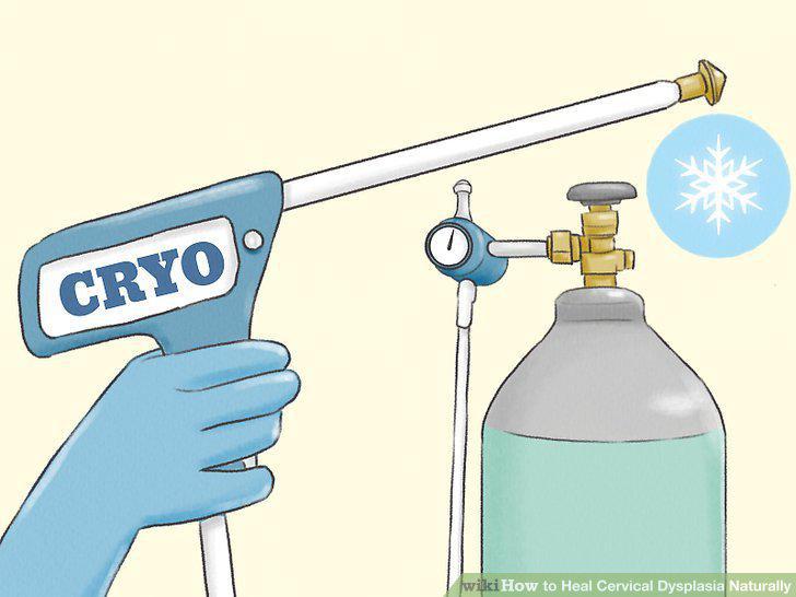 Step 10