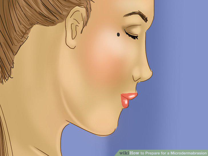 Step 2