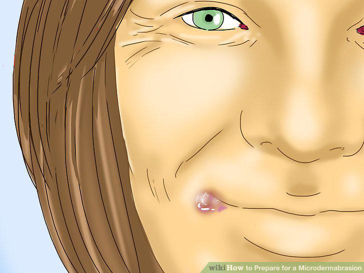 Step 13