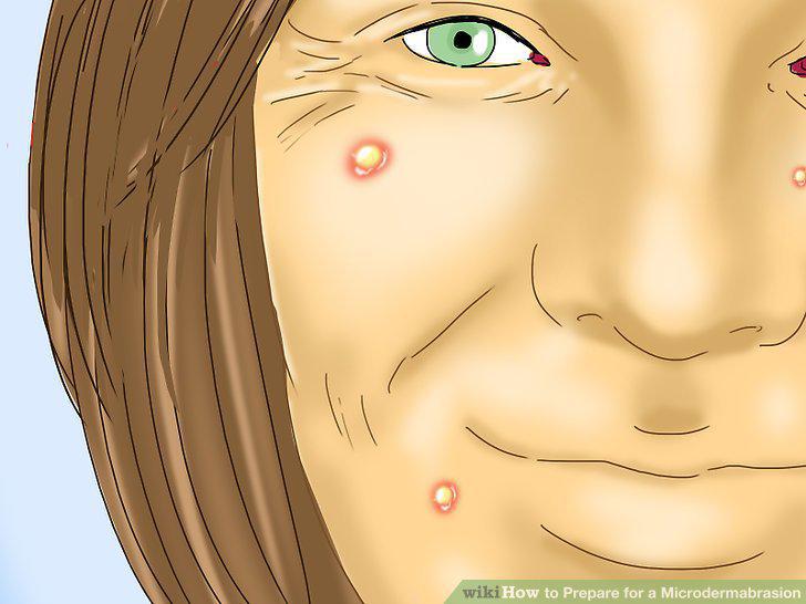 Step 15