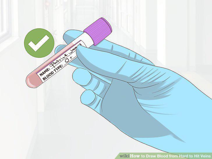 Step 11