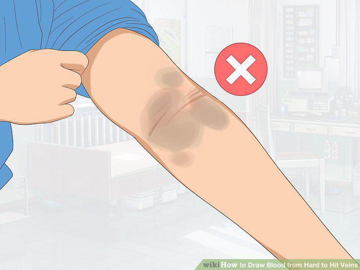 Step 13