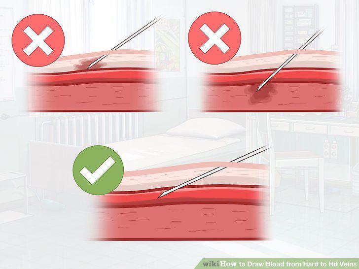 Step 14