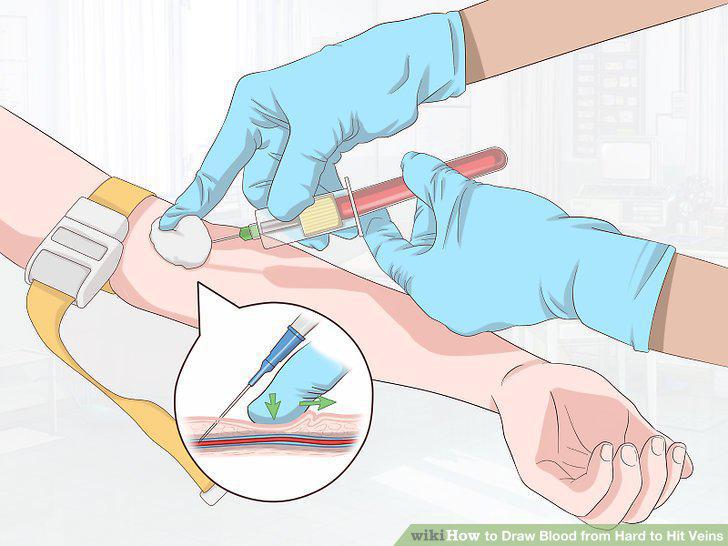 Step 8