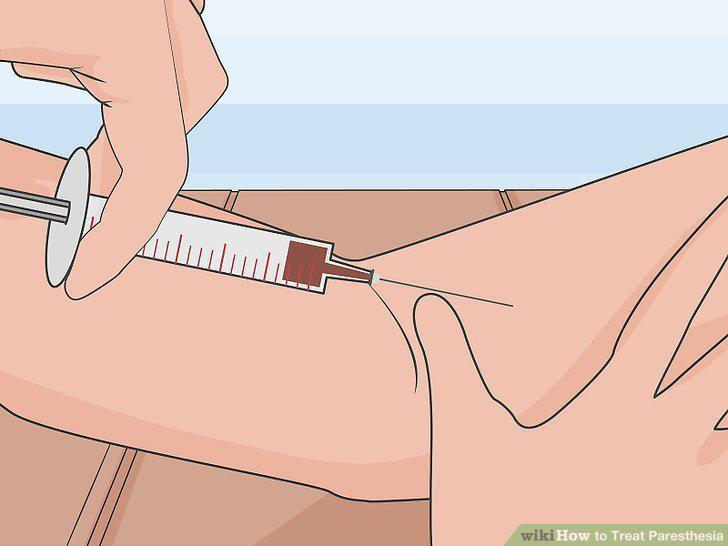 Step 10
