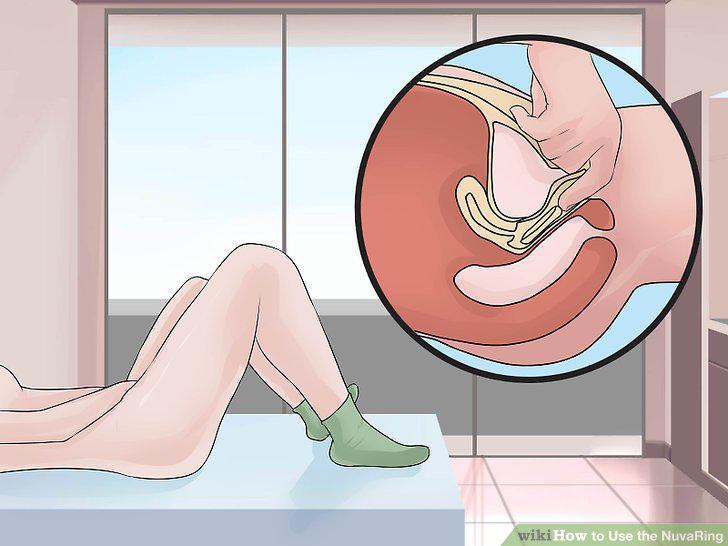 Step 9