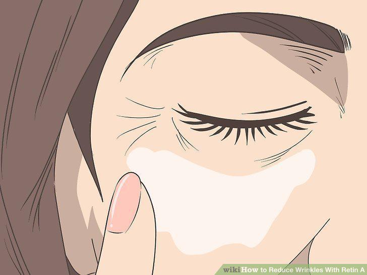 Step 3