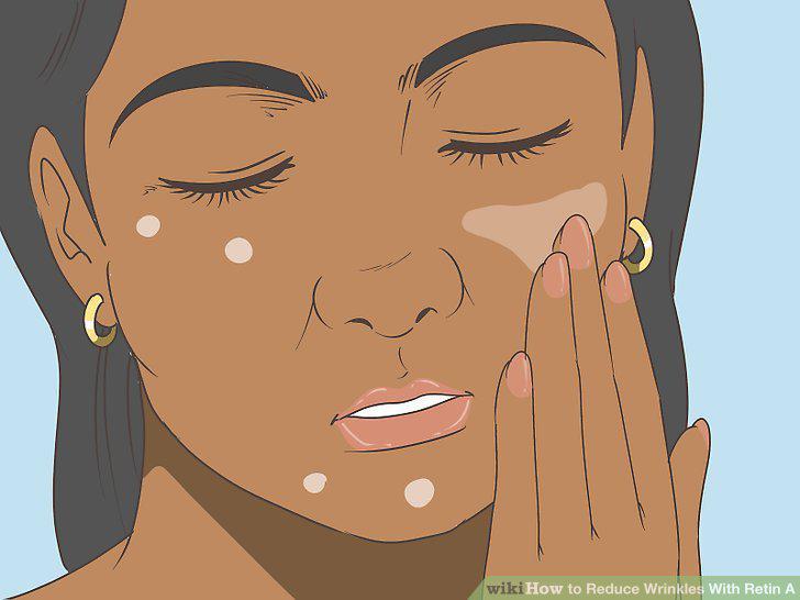 Step 9