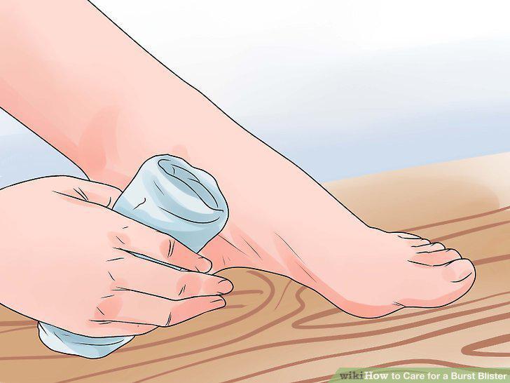 Step 2