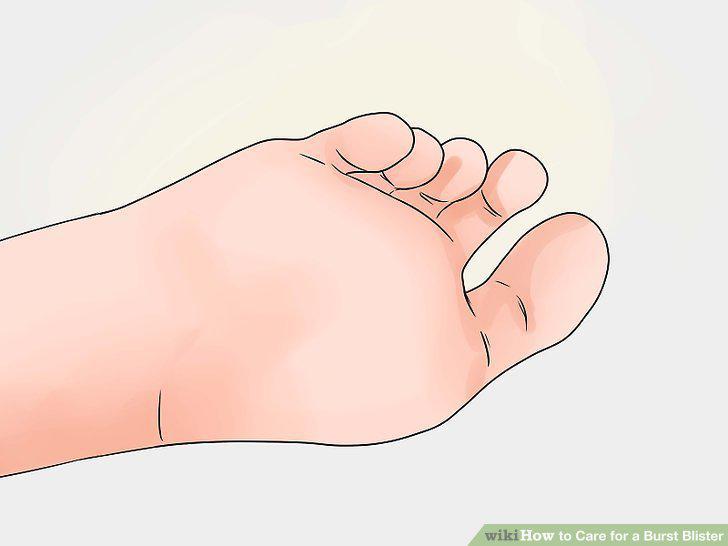Step 11