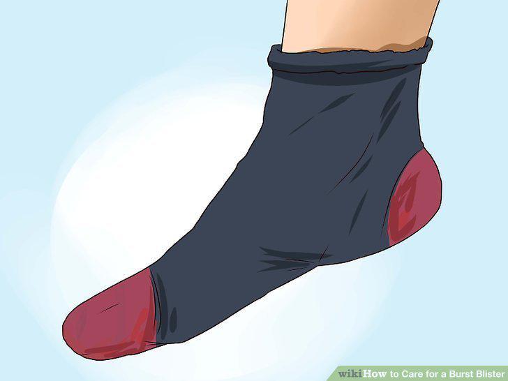 Step 14