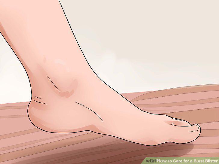 Step 15