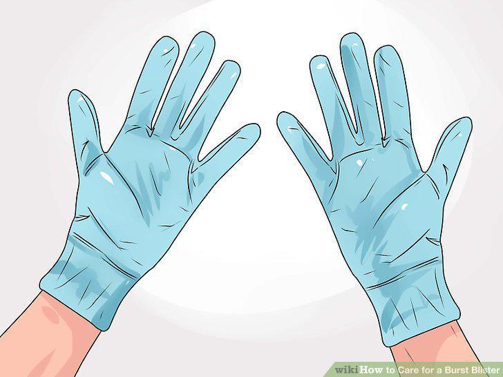 Step 16