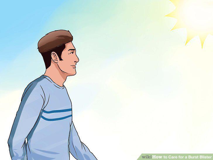 Step 17