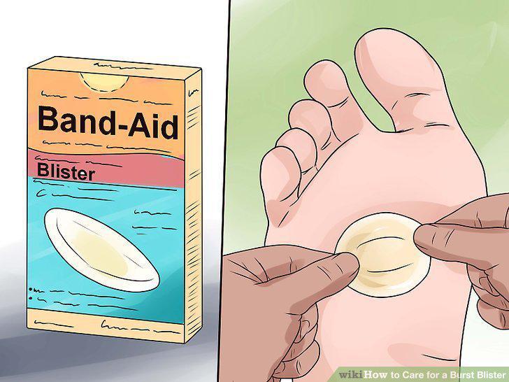 Step 7