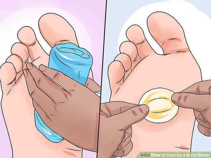 Step 8