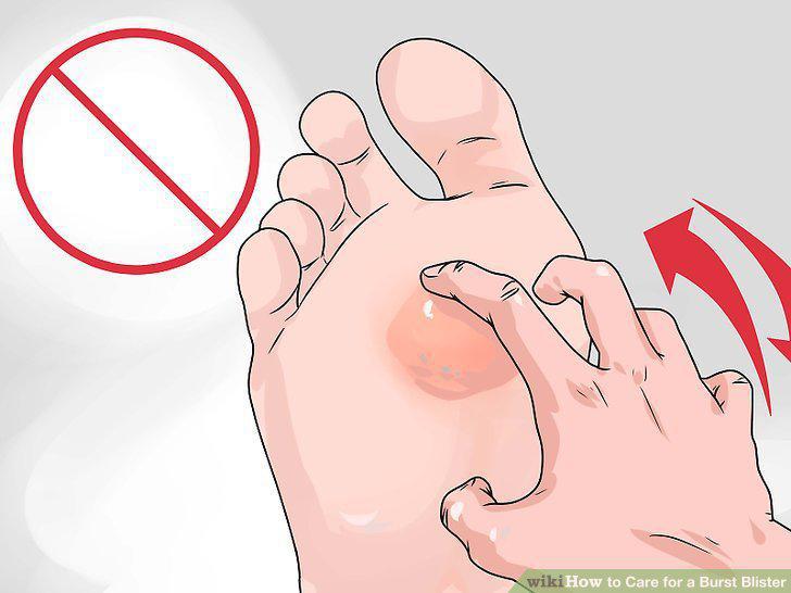 Step 9