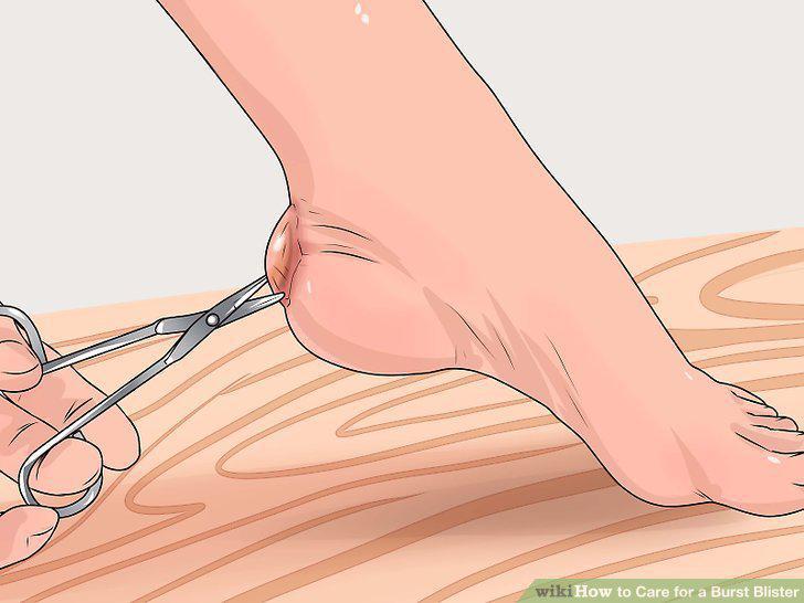 Step 10
