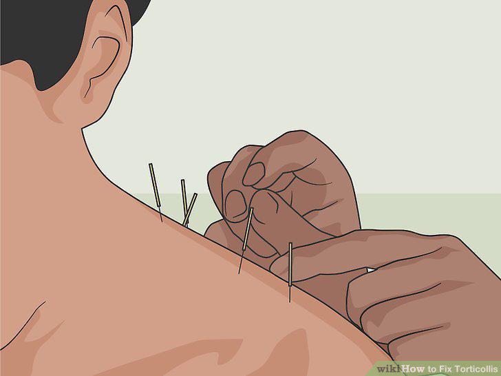 Step 8