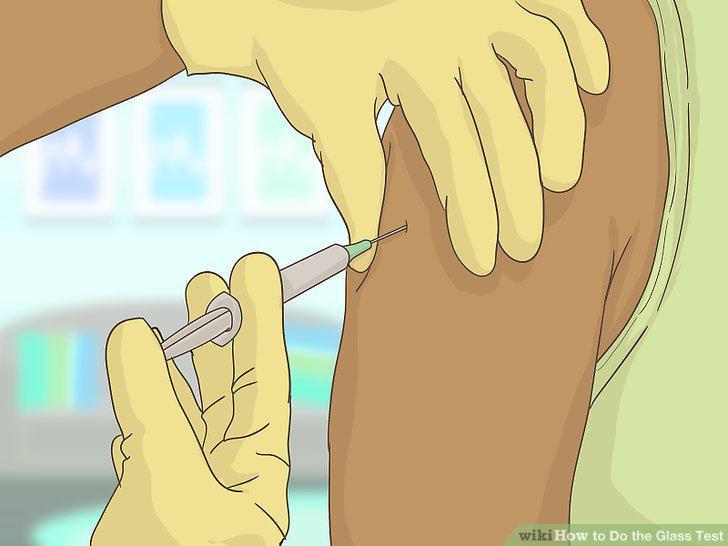 Step 14