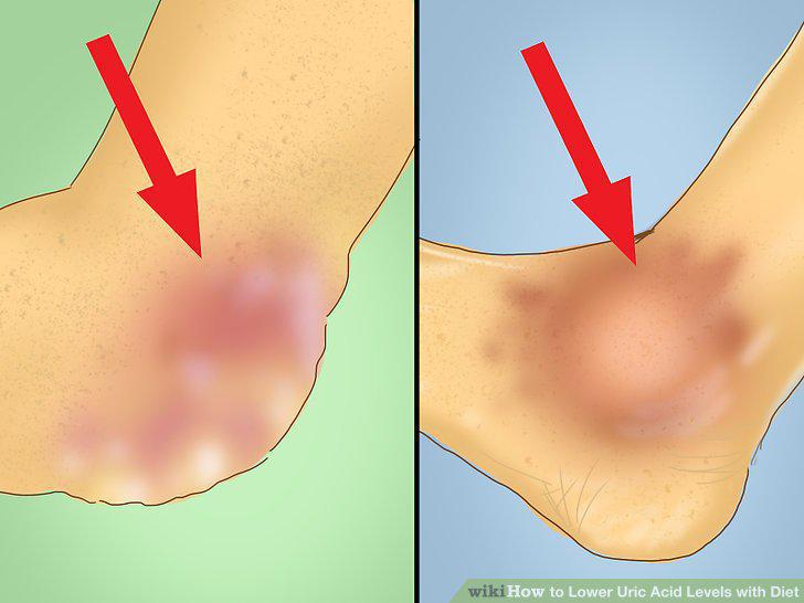 Step 10