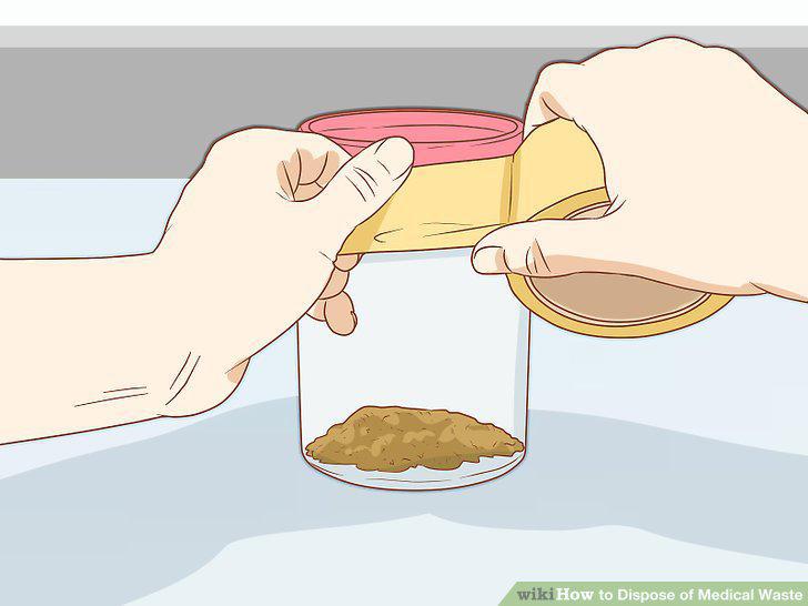 Step 17