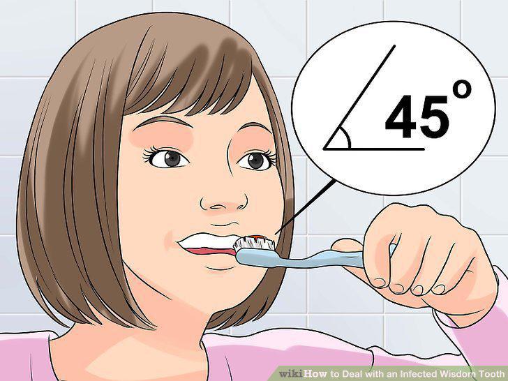 Step 12